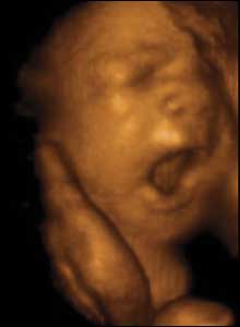 Infant at 12 weeks Pregnancy