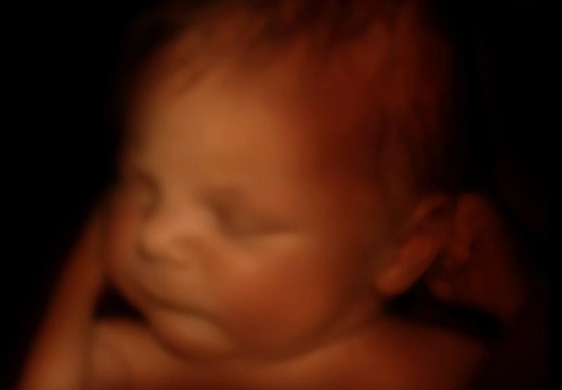 Baby in Mothers Womb - 3d Ultrasound